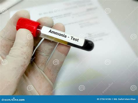 Ammonia Blood Test