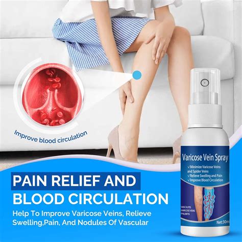 Buy Varicose Veins Treatment for Legs, Herbal Varicose Veins Spray ...