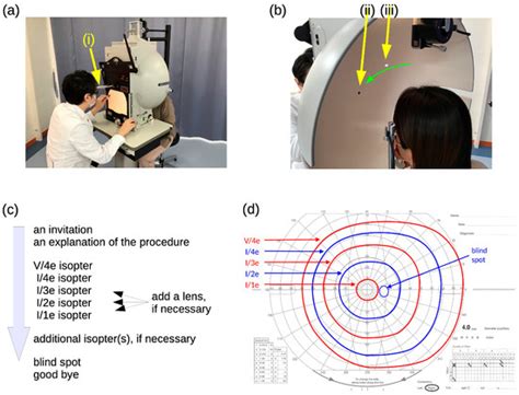 Stress Responses of Examiners during Ophthalmic Examination Practices ...