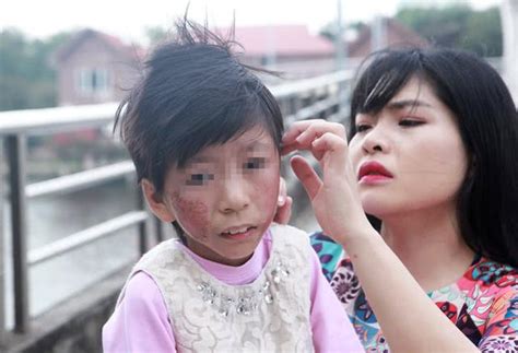 越南单身女孩不顾家人反对收养流浪女童，称将来结婚也要带着她 - 每日头条