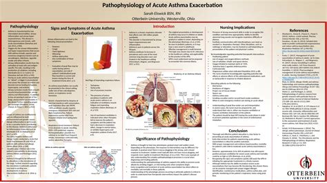 Exacerbation Of Asthma