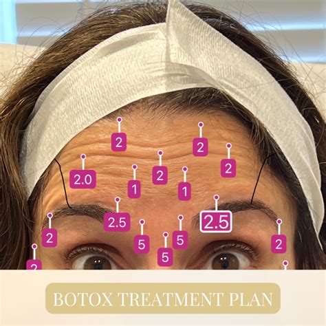 Image result for Botox Injection Demonstrations