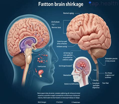What Causes Shrinkage of the Brain? A Simple Guide to Brain Health ...