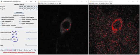 Image result for ImageJ Colocalization Coloc