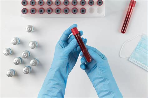 RDW Blood Test: Normal Range, Test Uses, Causes of High RDW