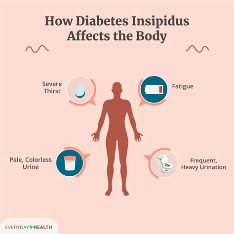 Diabetes Insipidus New Hope For Diabetes Insipidus: Exploring