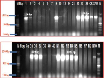 Detection of virulence genes and investigation of the immunogenicity of ...