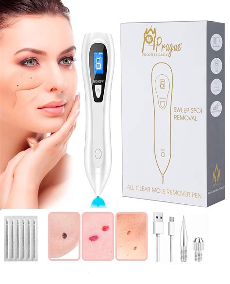 Prague Wart, Tag, and Mole Remover Laser Pen - Portable Skin Tag ...