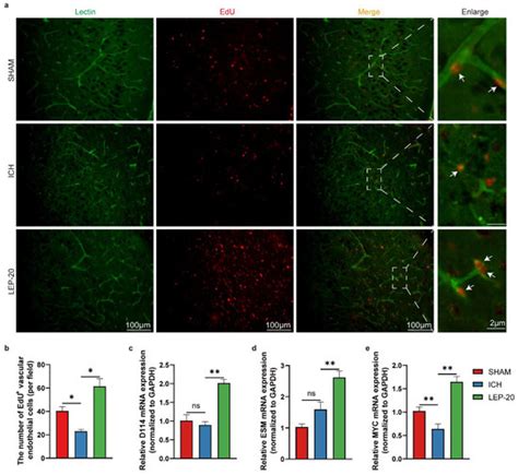 Leptin Promotes Angiogenesis via Pericyte STAT3 Pathway upon ...