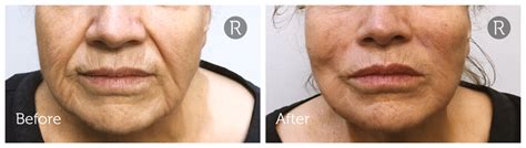 Spring Thread 的图像结果