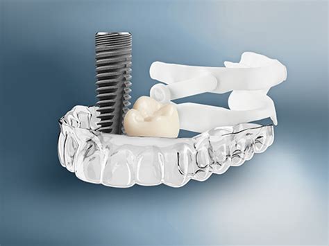 Intraoral Dental Scanners | Dentsply Sirona India