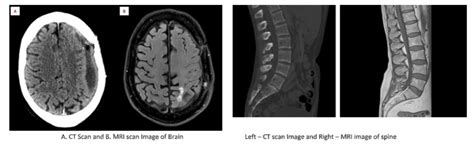 Know the differences and advantages of a CT Scan and an MRI Scan