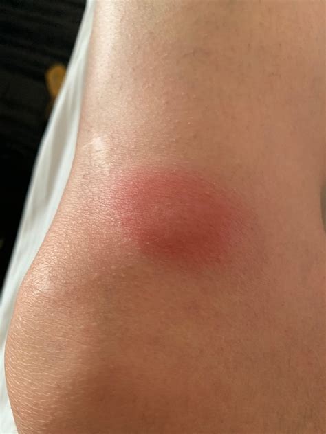 THE BAY CLUB HOTEL & MARINA (San Diego) - Hotel Reviews, Photos, Rate ...