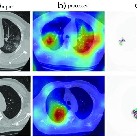 Image result for Grad Cam Visualization Custom CNN