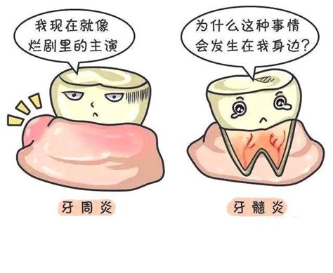 牙疼到发展出牙髓炎，能不能自愈？_炎症