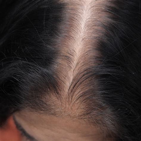 India’s first Women's Body Care Brand – Sanfe