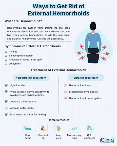 How to Get Rid of External Hemorrhoids in 48 Hours?