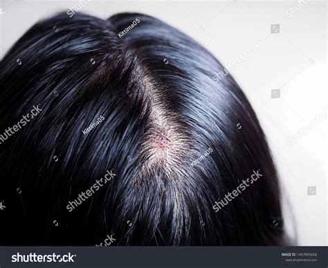 Mold That Looks Like Hair at Susanne Lumpkin blog