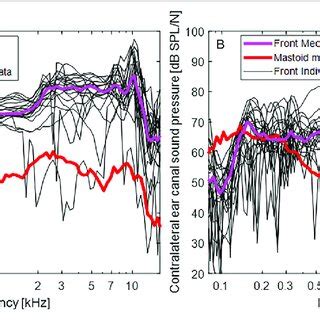 Image result for Contralateral Ear