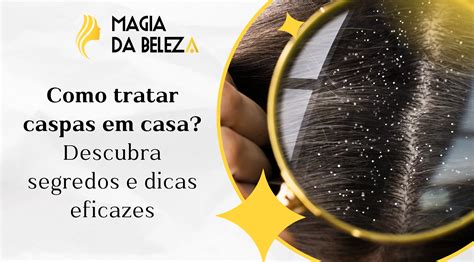 Como tratar caspas em casa? Descubra segredos e dicas eficazes