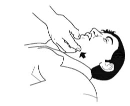 प्राथमिक चिकित्सा की एबीसी (ABC Of First Aid) - ITI Skills