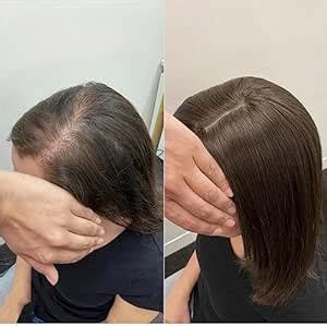 Gk Original Human Hair Golden Mirage Patch For Women, Black, 6X4 ...