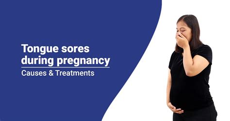Sore Tongue Early Pregnancy Sign - All about Sore Tongue during Pregnancy