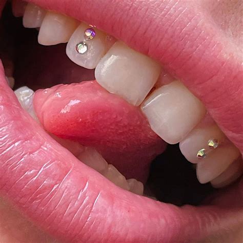 Image result for DIY Tooth Gems