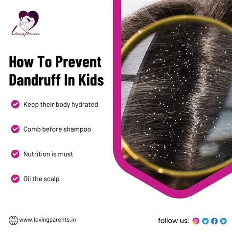 Do you know how to prevent dandruff in kids? | Loving Parents posted on the topic | LinkedIn