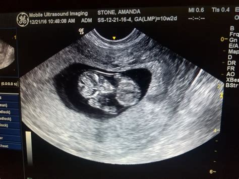 Image result for Alien Ultrasound
