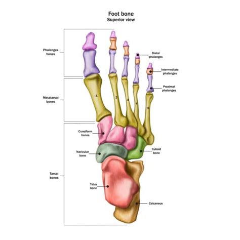 Foot Fracture (Surgery) | Pediatric Foot & Ankle Specialists