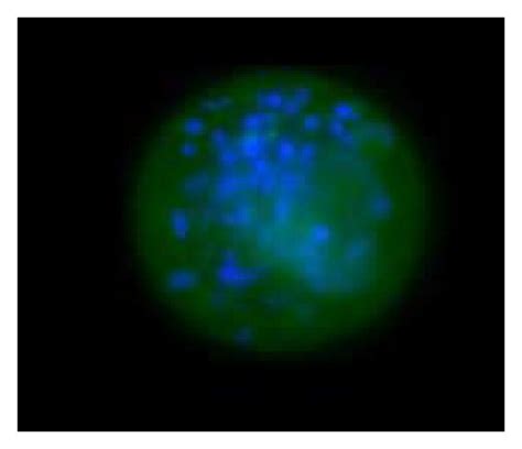 Image result for LPL LPAR