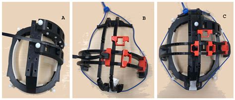 Improved Biomagnetic Signal-To-Noise Ratio and Source Localization ...