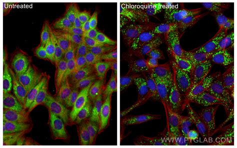 P62/SQSTM1 antibody (66184-1-Ig) | Proteintech