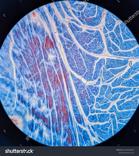 Photo Smooth Muscle Tissue Underr Microscope Stock Photo 2205081641 ...