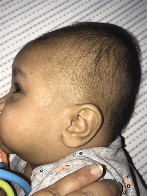 cone shaped baby head - Captions Nature