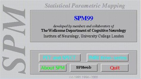 Image result for MATLAB SPM Model Analysis