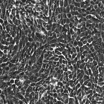Image result for Small Intestine Epithelial Cells
