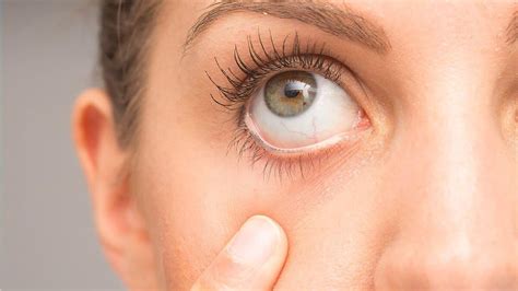 Image result for Sudden Vision Problems