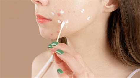 Best dark spot corrector: A guide to keeping your skin radiant