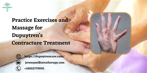 What Hand Exercises Are Good For Dupuytren's Contracture at JENENGE blog
