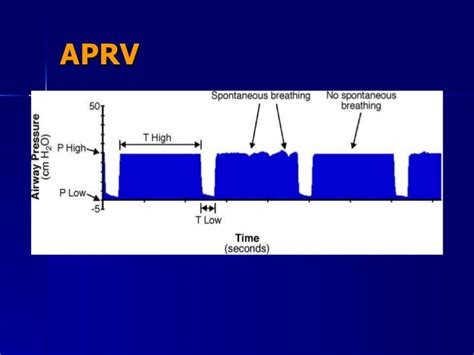 Image result for APRV Mode Explained