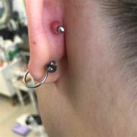 Have You Noticed Cartilage Piercing Bumps? Here Are Some Tips To Get ...