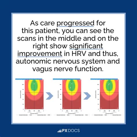 Is POTS Genetic? Understanding the Root Causes | PX Docs