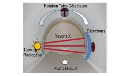TDM Scanner 的图像结果