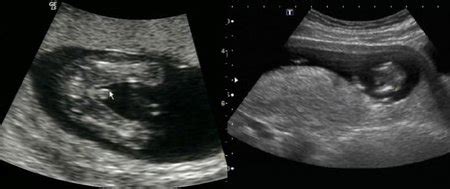 Chicas, alguna puede ver el sexo de mi bebe?? plisss XD | BabyCenter