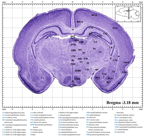 Rat Brain Stereotaxic Atlas at Floyd Holley blog