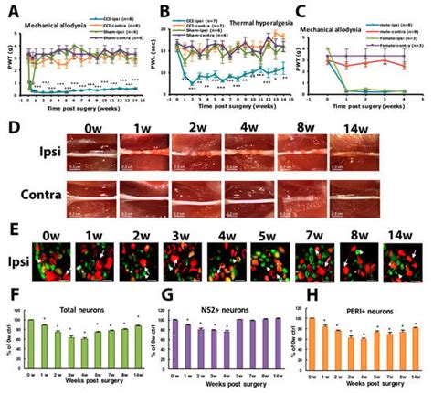 Deletion of Acid-Sensing Ion Channel 3 Relieves the Late Phase of ...