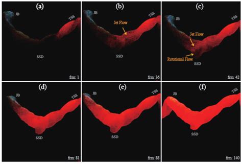 Image result for Dye Flow Visualization