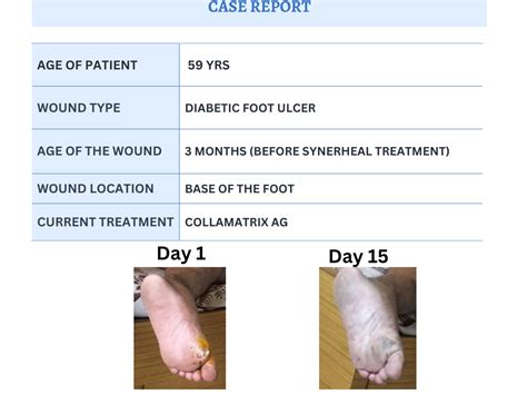 Case_report – Synerheal Pharmaceuticals